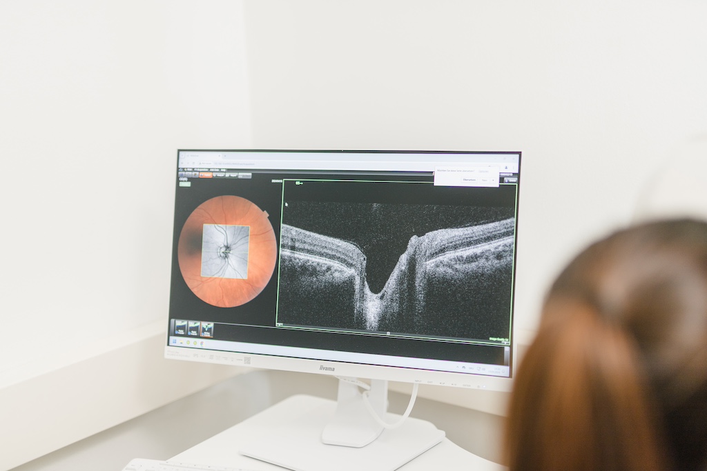 Augenarzt 1210 Wien 2 netzhautdiagnostik
