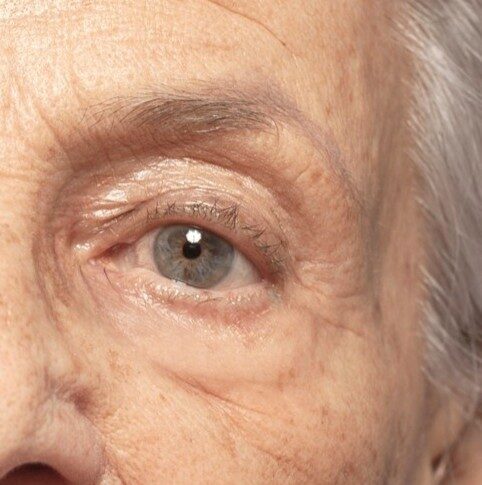 Ophthalmologist Stockerau 9 Close-up of an eye of an elderly person